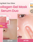 [Amazon] Collagen Gel Mask & Collagen Peptide Serum