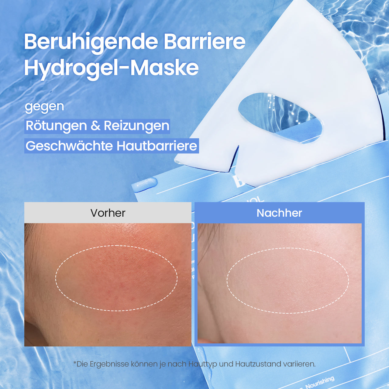 [Weltweit Nr. 1 Hydrogel-Maske] Cera-nol Maske | Senkt die Hauttemperatur | Oligo-Hyaluronsäure | Alpen-Gletscherwasser