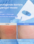 [Weltweit Nr. 1 Hydrogel-Maske] Cera-nol Maske | Senkt die Hauttemperatur | Oligo-Hyaluronsäure | Alpen-Gletscherwasser