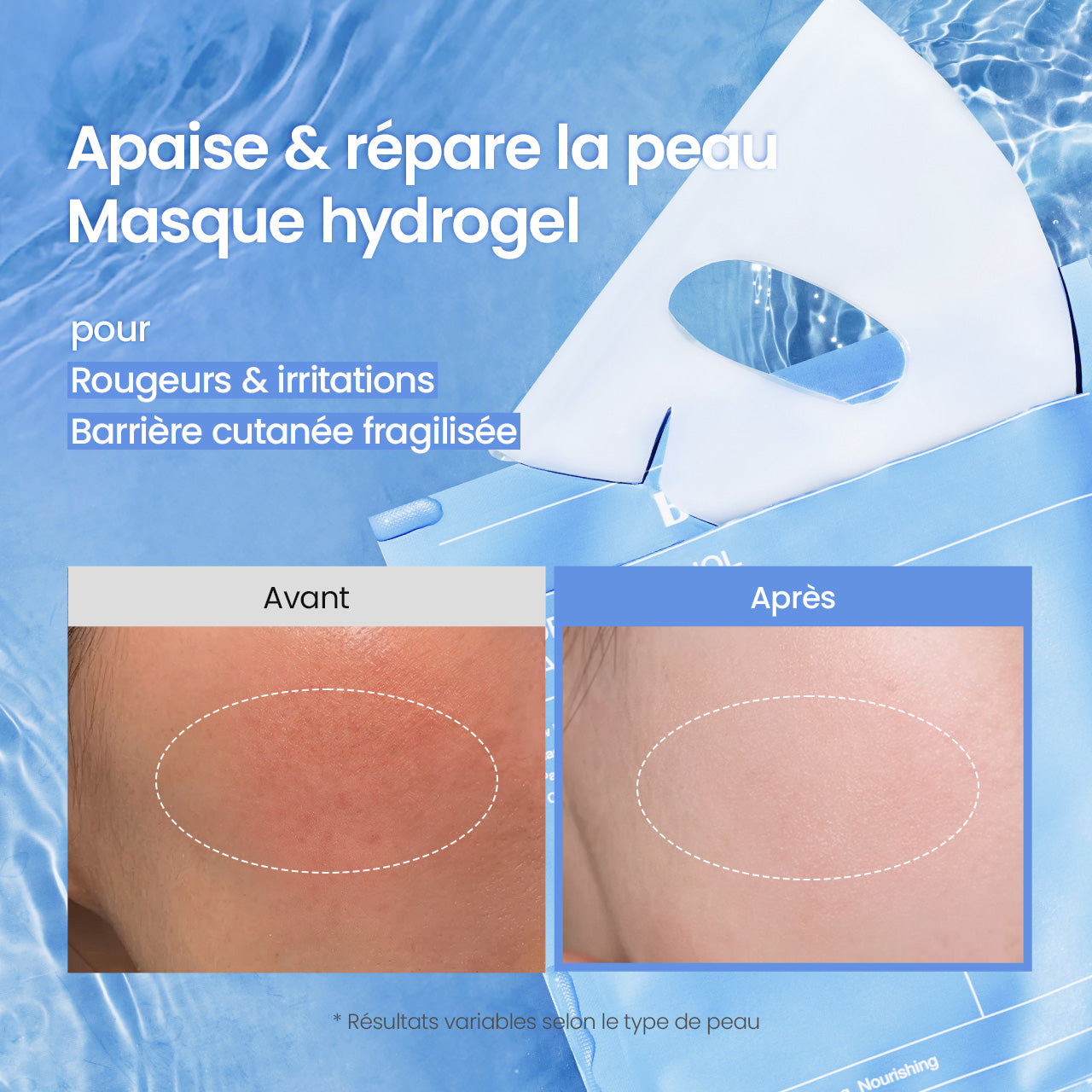 [Masque hydrogel N°1 mondial] Masque Cera-nol | Abaisse la température cutanée | Oligo-acide hyaluronique | Eau glaciaire alpine