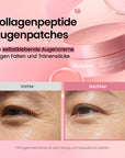 [Amazon Nr.1] 218M+ verkauft | Biodance Kollagen Peptide Augenpads