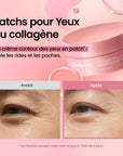 [N°1 sur Amazon] 218M+ vendus | Patchs pour Yeux au Collagène