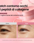 [Amazon N.1] Oltre 218 milioni venduti | Biodance Patch Occhi al Collagene e Peptidi