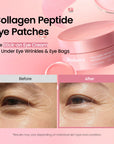 Collagen Peptide Eye Patches