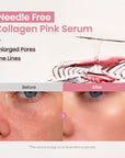 [Amazon] Collagen Pink Serum