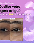 [N°1 sur Amazon] 324M+ vendus | Patchs pour Yeux au PDRN Caviar