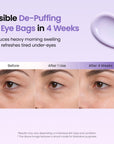[Amazon] BIODANCE PDRN Eye Cream