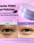 Caviar PDRN Eye Patches